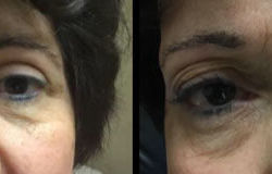 Before & After Photos