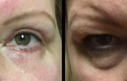 Before & After Photos