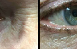 Before & After Photos