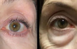 Before & After Photos