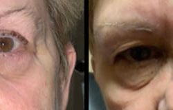 Before & After Photos