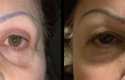 Before & After Photos