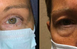 Before & After Photos