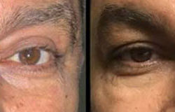 Before & After Photos