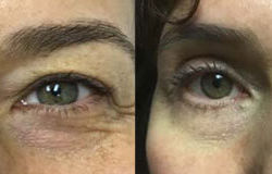 Before & After Photos